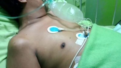 Kaki dan Perut Alami Pembengkakan, KPPS 042 Jatibening Meninggal