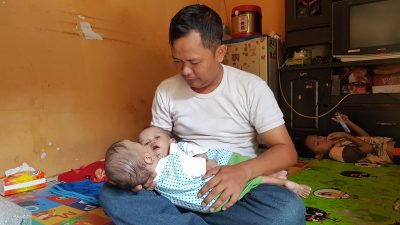 Ayah Bayi Kembar Siam Rahman dan Rahim Beberkan Kisah Kandungan Istri
