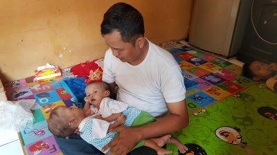 Tolong...! Bayi Kembar di Bekasi Butuh Bantuan
