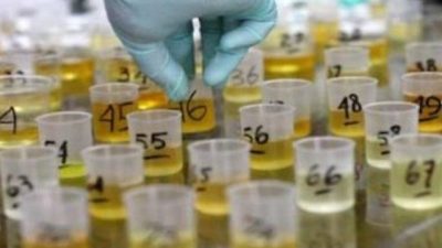 Bekasi Bebas Narkoba, Pegawai BUMD dan PNS Ditantang Tes Urine Setiap 6 Bulan