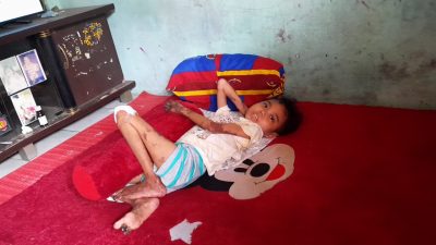 Balqis Aulia Rahma mengidap penyakit langka Vaskulitis