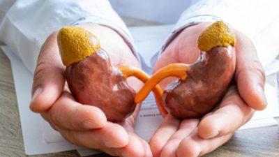 2 Anak di Kabupaten Bekasi Meninggal Diduga Terjangkit Gagal Ginjal Akut