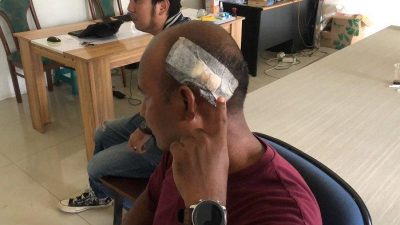 Satpam Apartemen Kemang View alami luka di kepala akibat dikeroyok pria mabuk. Foto: Ist
