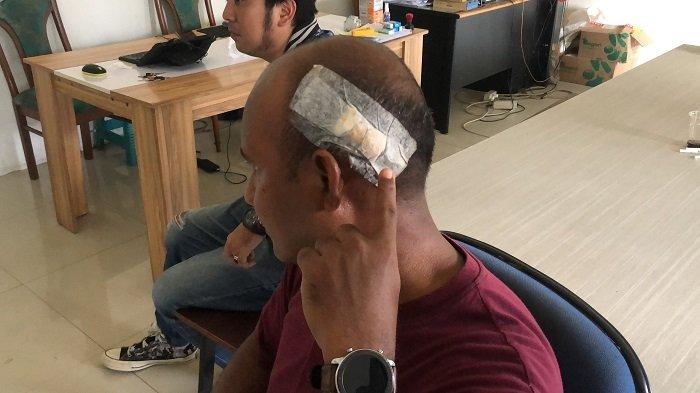 Satpam Apartemen Kemang View alami luka di kepala akibat dikeroyok pria mabuk. Foto: Ist