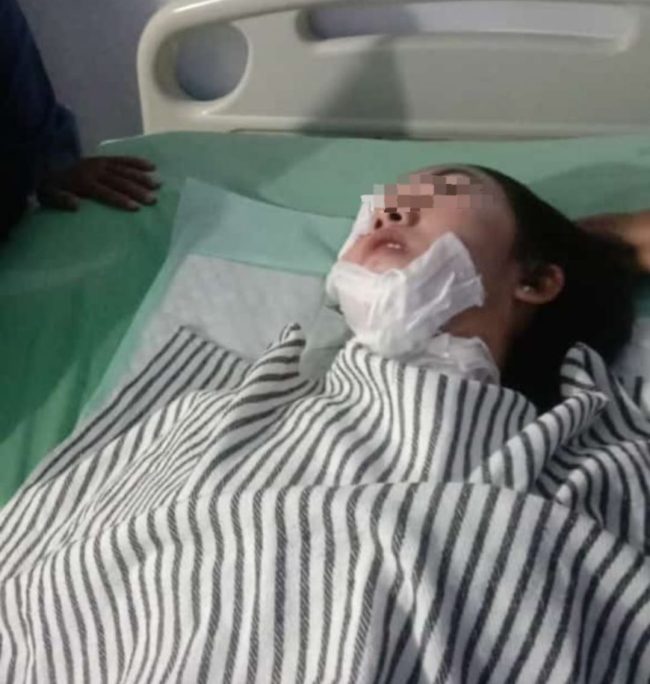 Korban Penyiraman Air Kepas di Jalan Raya Perjuangan Teluk Pucung Bekasi Utara