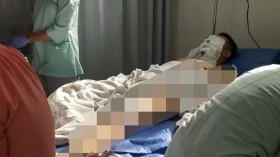 Korban Penyiraman Air Keras di Medan Satria, Kota Bekasi. Foto: ist
