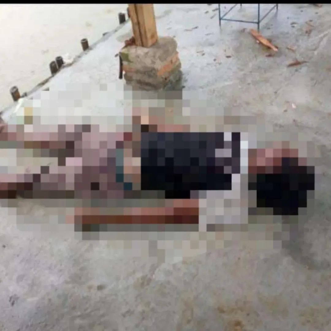 Kondisi korban tersambar petir saat memancing