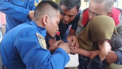 Petugas Disdamkarmat Kabupaten Bekasi membongkar gagang sapu yang menjepiti jari balita.
