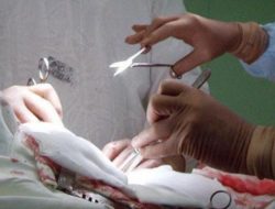 Kondisi Terkini Korban Bacokan di Cikarang, Tangan Sudah Diamputasi