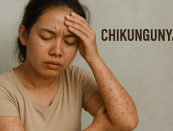 172 Kasus Dugaan Chikungunya Muncul di Bekasi