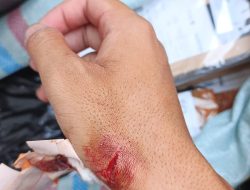 Kurir JNT Bekasi Luka Akibat Penusukan Pelanggan, Dipicu Masalah Pembayaran COD