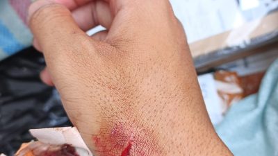 Kurir JNT Bekasi Luka Akibat Penusukan Pelanggan, Dipicu Masalah Pembayaran COD