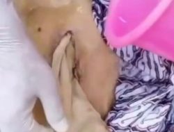 Viral! Wanita Bekasi Meninggal Usai Operasi, Luka di Perut Tak Dijahit dan Dipenuhi Kasa