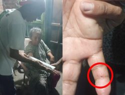 Damkar Kota Bekasi Selamatkan Nenek Pemulung Korban Gigitan Ular di Cikarang Utara