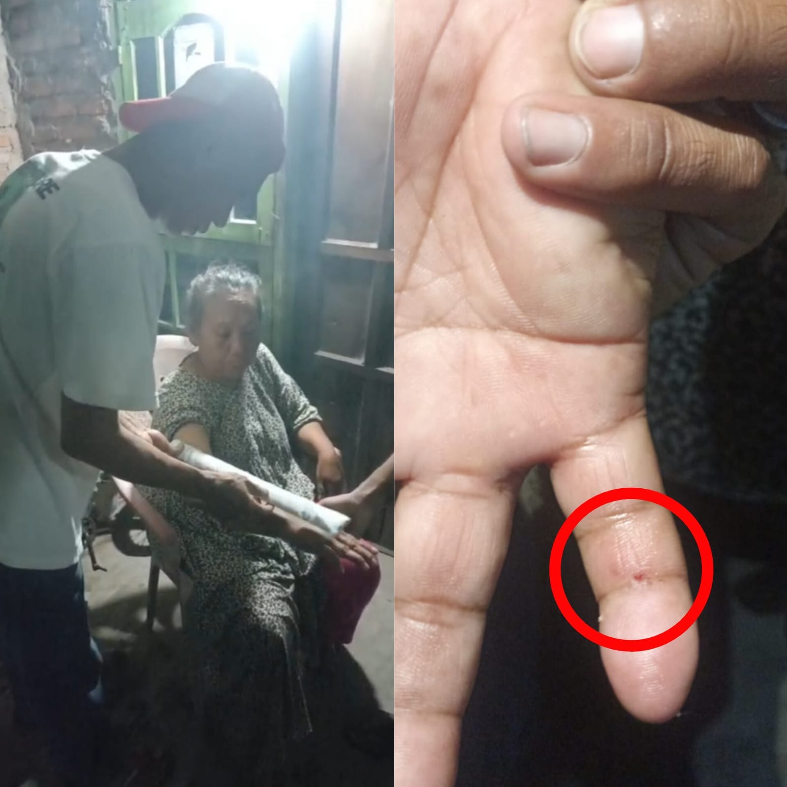 Bekasi - Damkar Kota Bekasi saat melakukan pertolongan kepada nenek pemulung yang menjadi korban gigitan ular berbisa. Foto: Ist/Gobekasi.id.
